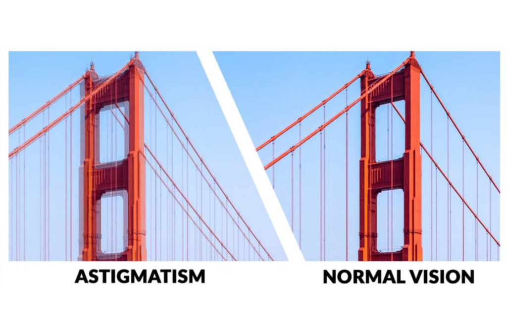 Two images of a bridge, one representing clear and normal vision and the second image is blurry, representing what astigmatism looks like