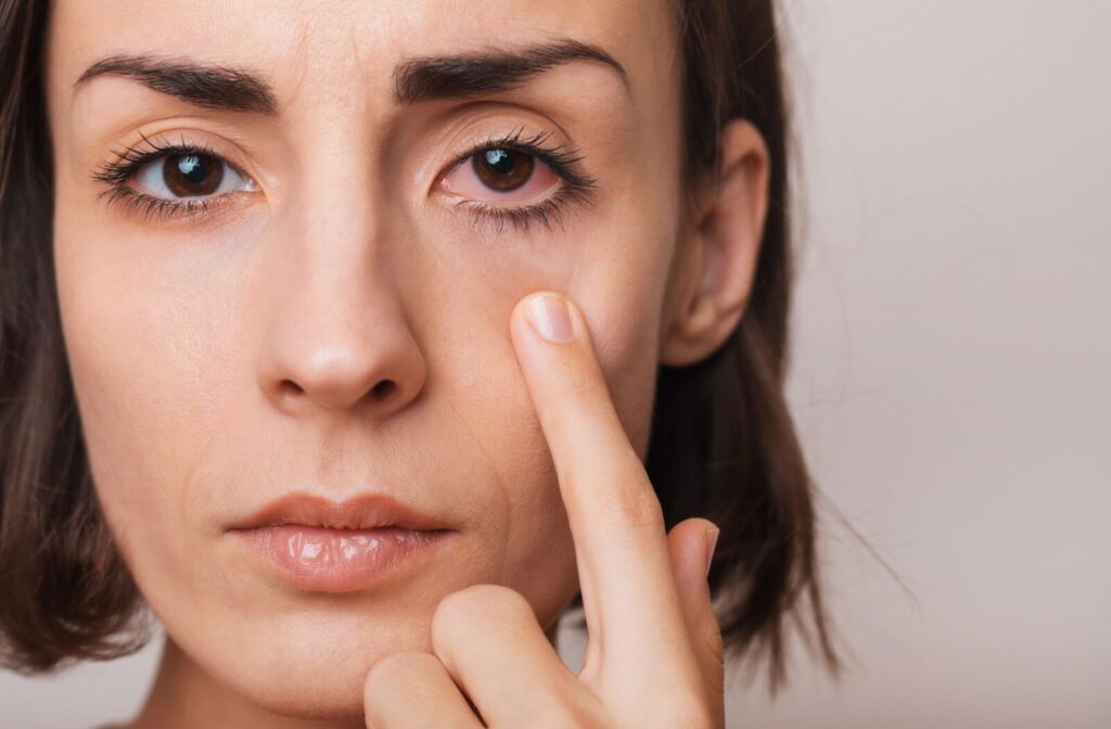 A woman pointing to a red, bloodshot eye in a mirror, illustrating how to identify visual signs when wondering "how do I know if I have dry eyes?